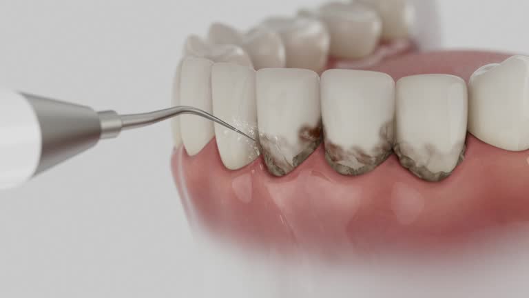 Reliable Dental Implants contractor in Rose Valley, PA by Smile Center Dentistry